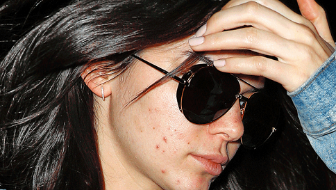 12 Best Kendall Jenner Without Makeup | Styles At Life