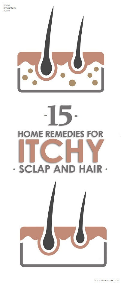 Acasă remedies for itchy scalp