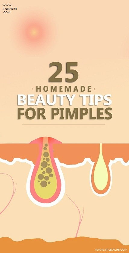 tips for pimples