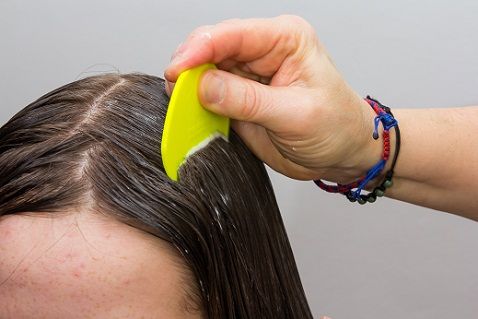 Home Remedies for Dandruff - Clean scalp