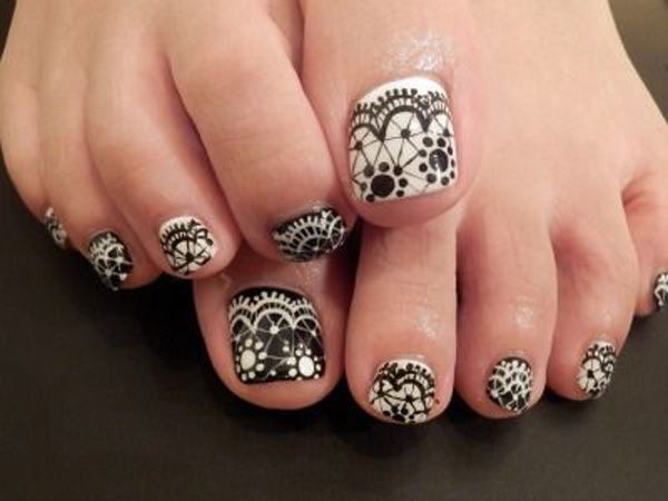 Fekete and white toenails