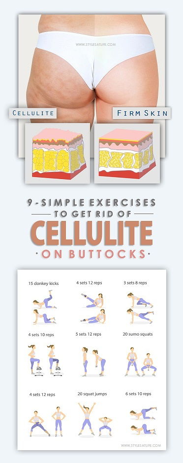 pratimai to get rid of cellulite on buttocks