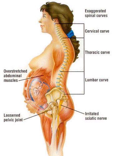 Back Pain during Pregnancy 2
