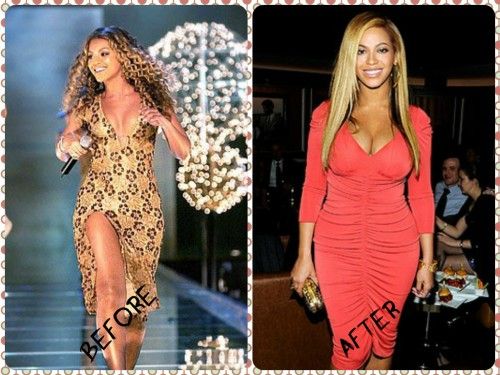 Beyonce Plastic Surgery 