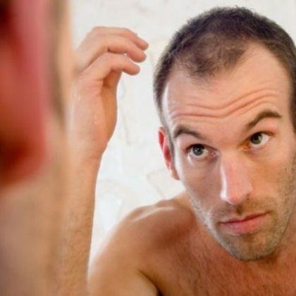 Cum Does DHT Cause Hair Loss