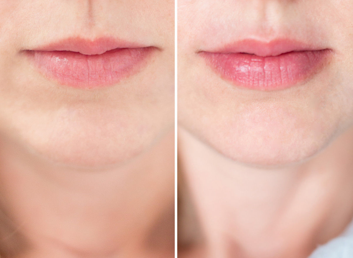 Editor's Pick: Najboljši pripomoček za ustnice za polne ustnice brez injekcij