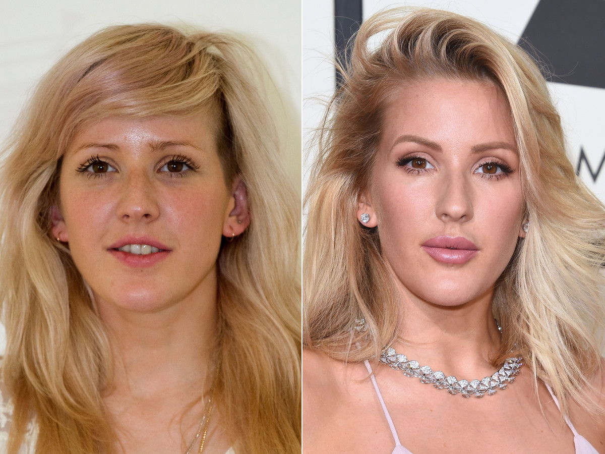 Ellie Goulding, Before and After