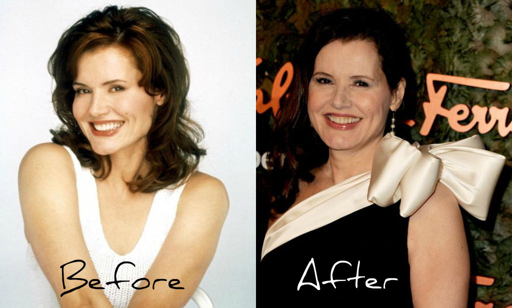 Geena Davis Before & After