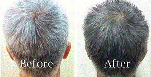 Gorčica Oil Reversing Grey Hair 2