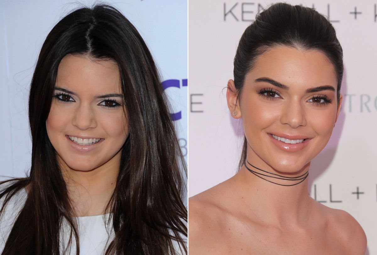 Kendall Jenner, pred in po