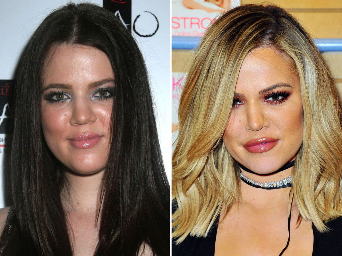 Khloé Kardashian, înainte și după