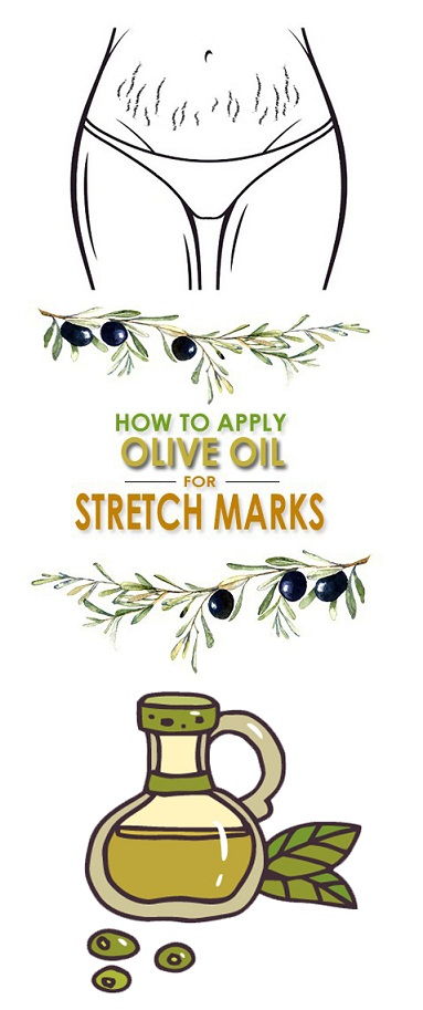 Olive Oil for Stretch Marks
