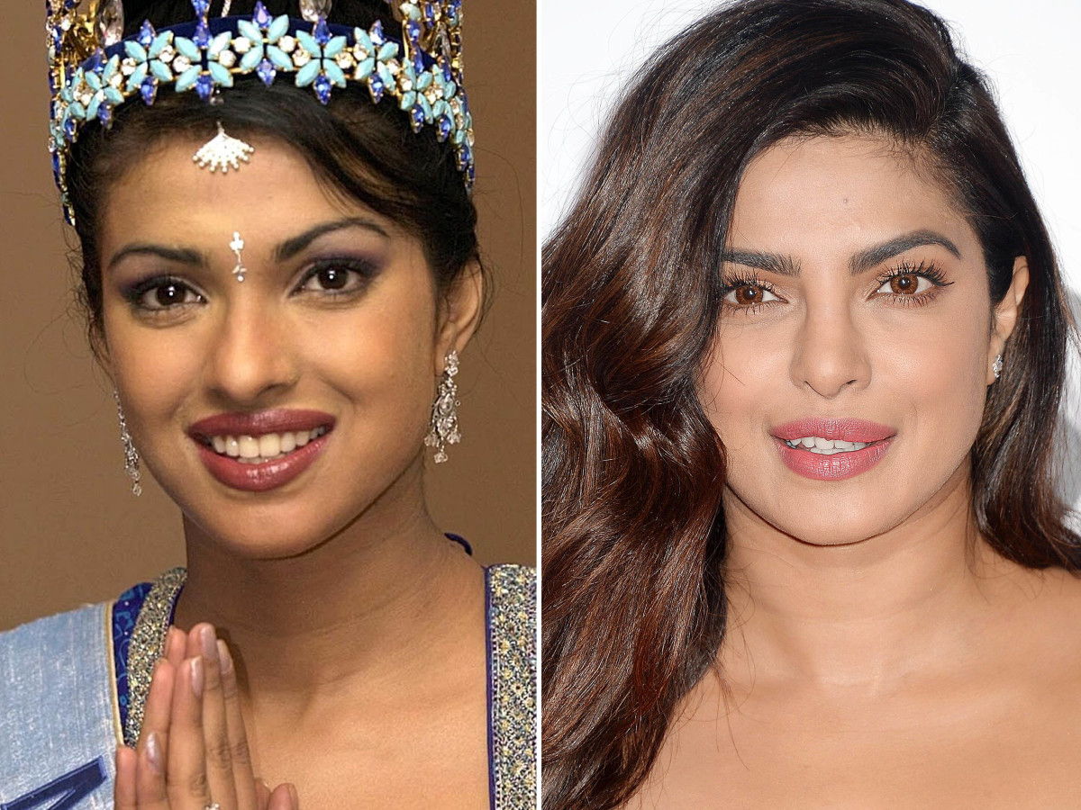 Priyanka Chopra, Before and After