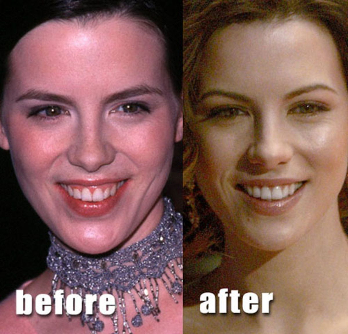 These Celebs are Examples of Good Plastic Surgery