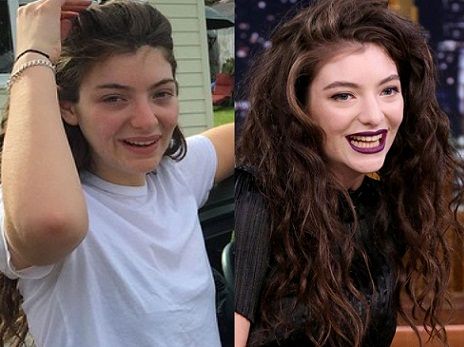 Lorde without makeup7
