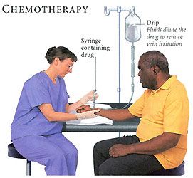 Chemoterapija